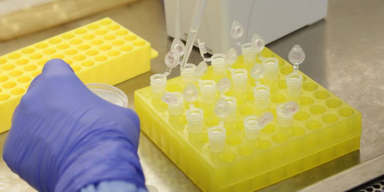 G-20: Coronavírus constitui novo risco para a economia global, OMDN, O Mundo dos Negócios